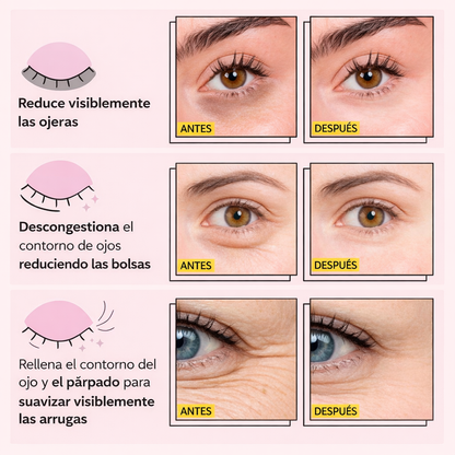 Parches oculares InstaLift con PDRN y colágeno