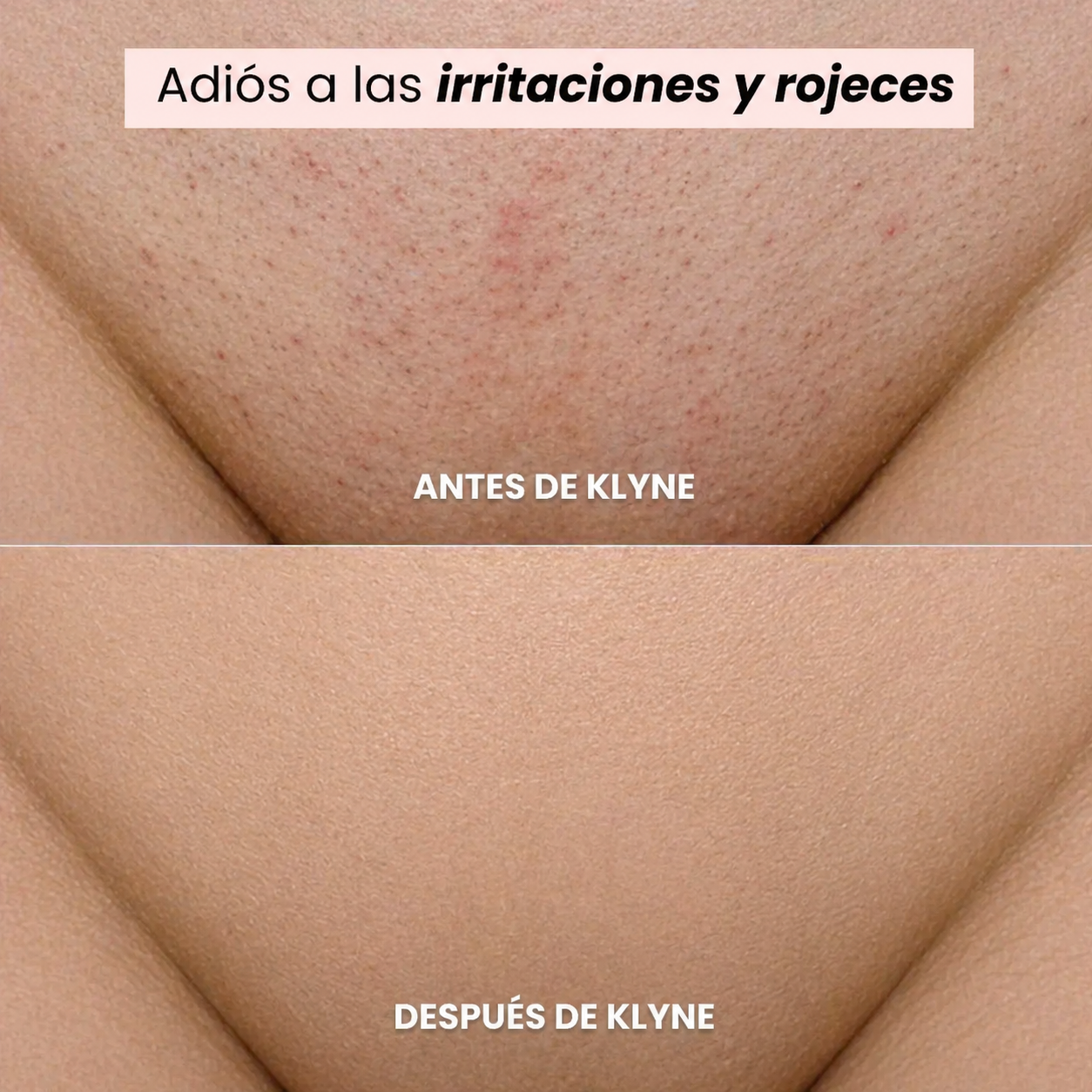 Afeitadora KLYNE®